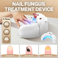 Advanced Nail Fungus Treatment & Repair Device – Home Solution for Fingernails & Toenails - AxenBox