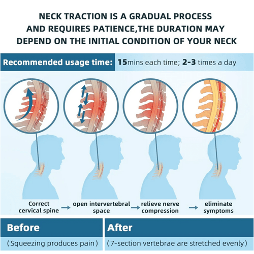 Cilious Gen-2 Neck Traction Collar