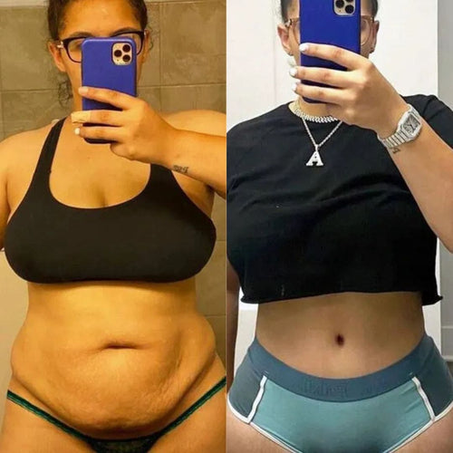 Ultrasonic Cavitation